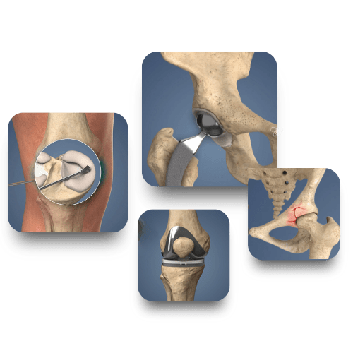 Illustration of advanced orthopedic care in Dubai by Dr. Ahmed El-Bakoury