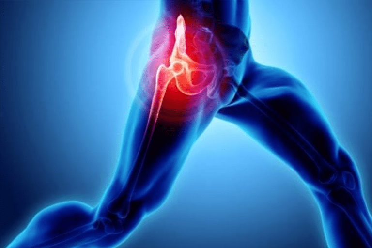 Illustration of hip arthroscopy procedure