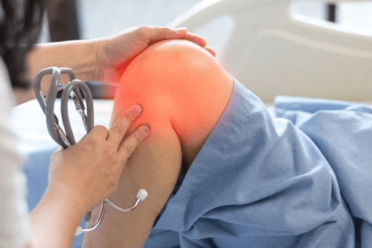 Illustration of knee arthroscopy procedure