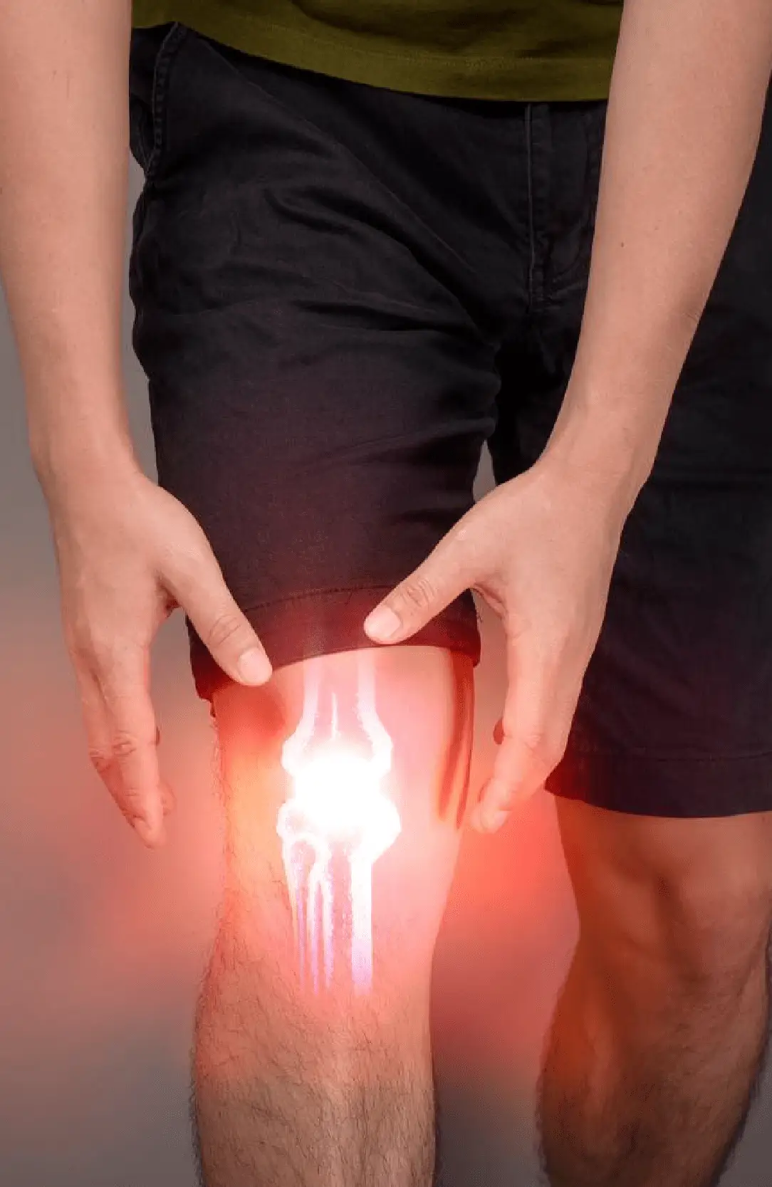 Knee replacement surgery by Dr. Ahmed El-Bakoury